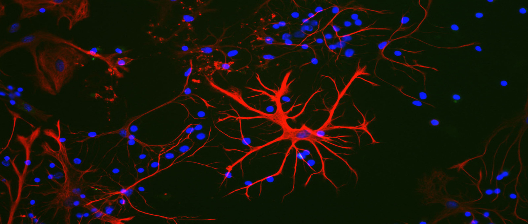 Immunohistochemistry at Cell Signaling Technologies